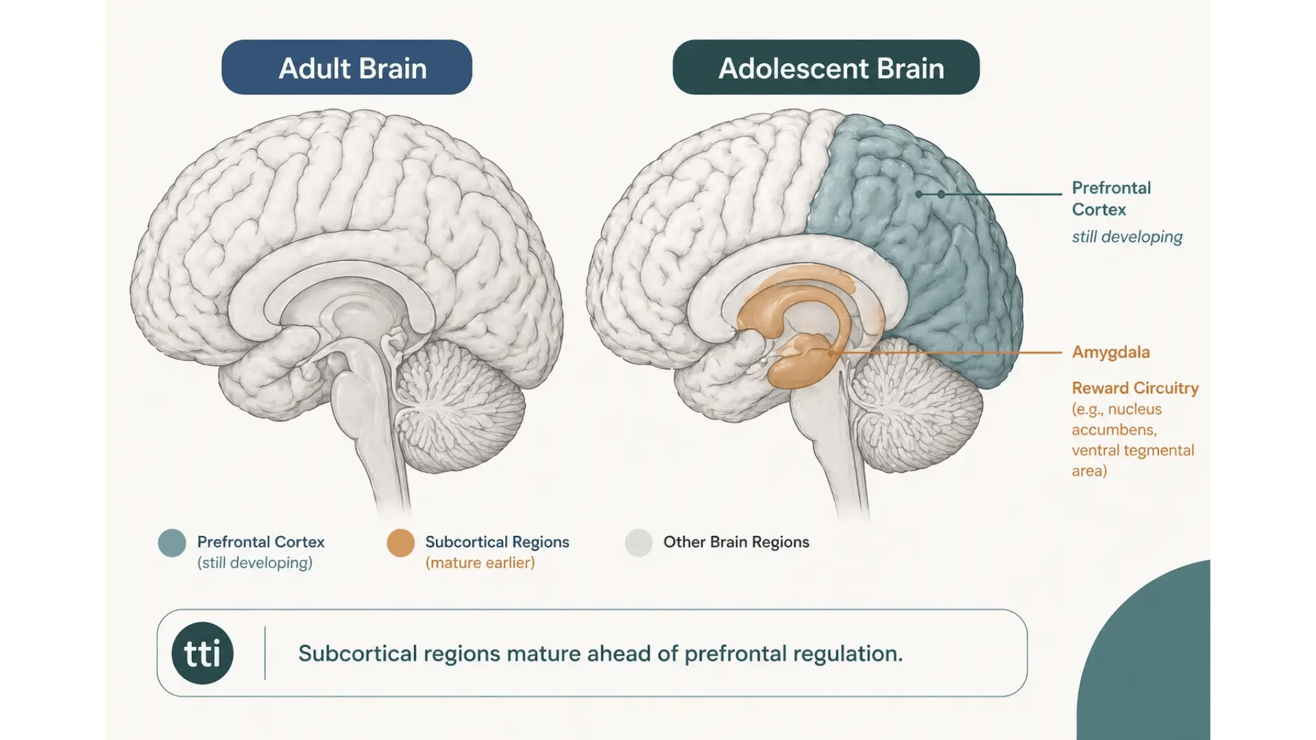 adolescent-brain-development-imbalance-TTI